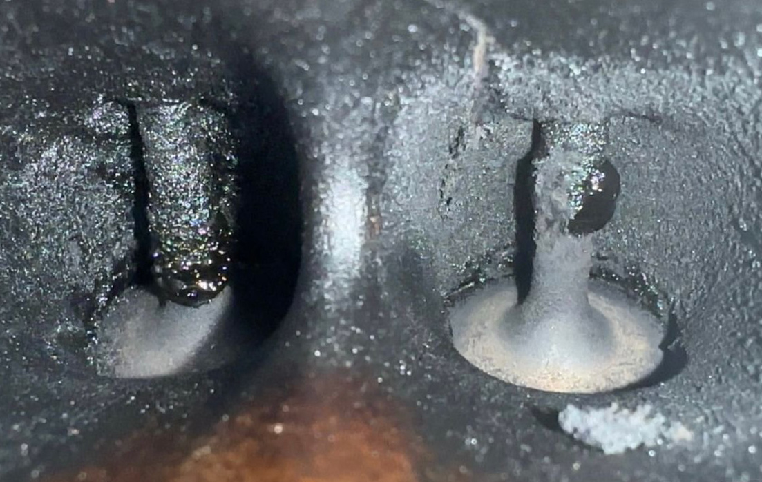 Πριν την θεραπεία